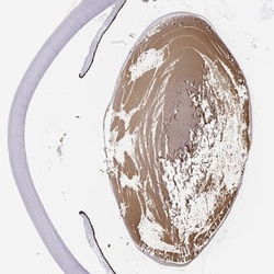 LGSN Antibody, Novus Biologicals:Antibodies:Primary Antibodies